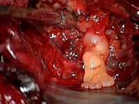 A foot grows inside a babys brain