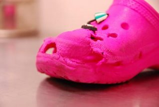 Croc backlash