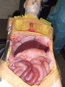 Surgical model
