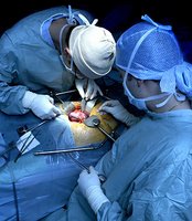 The demise of a liver transplant program