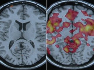 Which brain is lying?