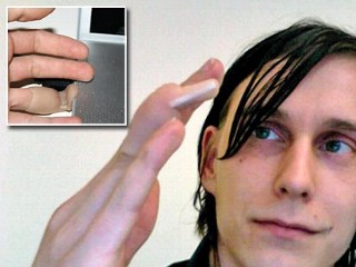 The man who had a USB flash drive as a finger