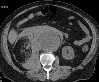 Guess the diagnosis