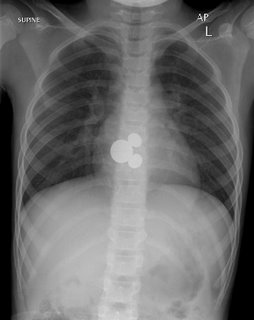 Mickey Mouse sign