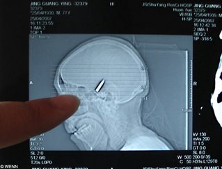 Bullet in the head, part 2
