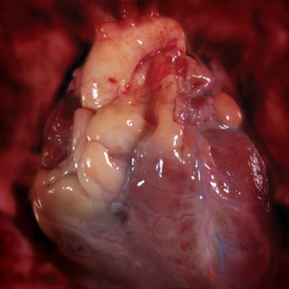 The heart: Photoshopped or not?