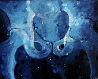 Pelvic "x ray"