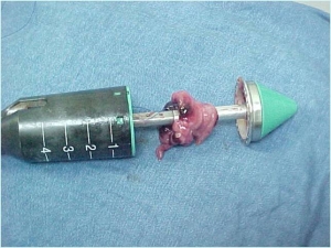 Guess the procedure