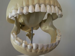 Pac man’s skull Pac man’s skull