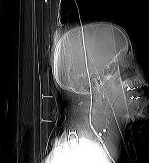 Inside Terrorism: The X ray Project