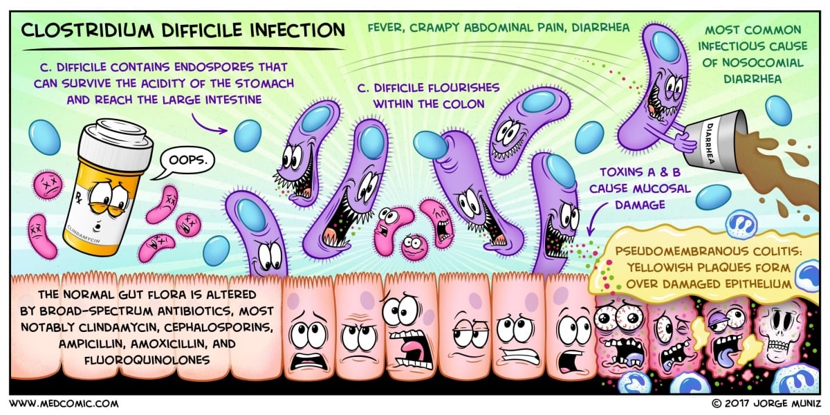 clostridium difficile colitis fogyás)