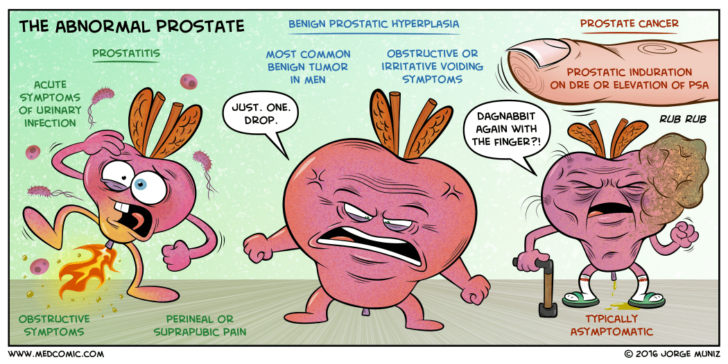 loss of median sulcus prostate