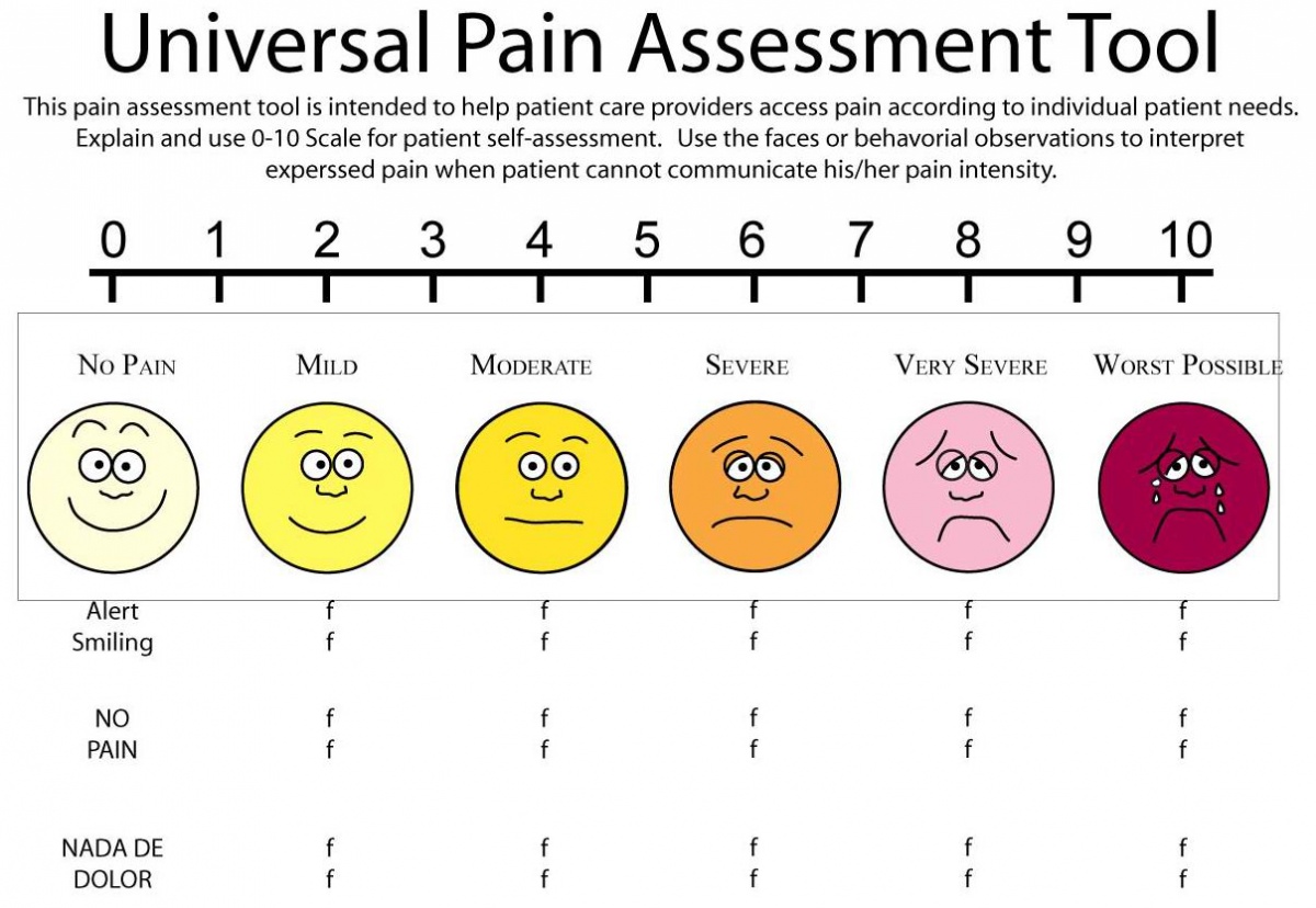 Intensity Scale Chart