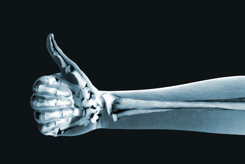 Bulk-billed Ct Scans