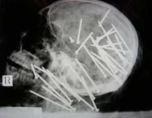 nailgun xray