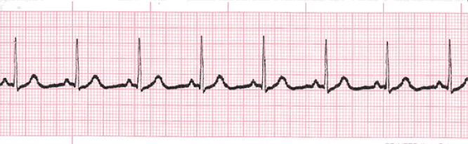 sinus9